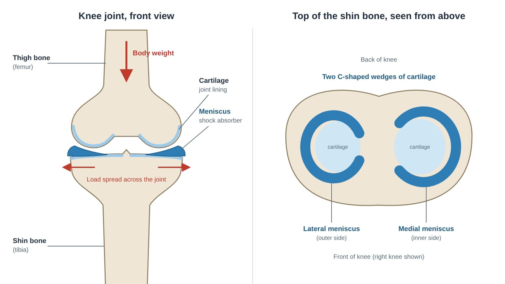 How meniscus repair and HTO saves your natural joint?